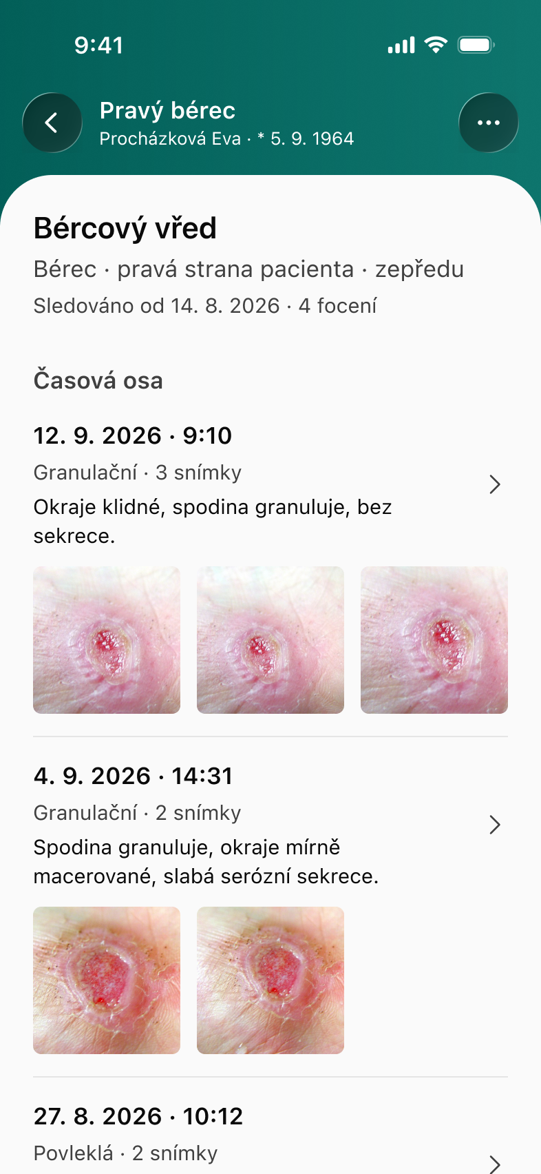 Ansora Vulna wound timeline with dated photographs, healing stages and clinical notes.