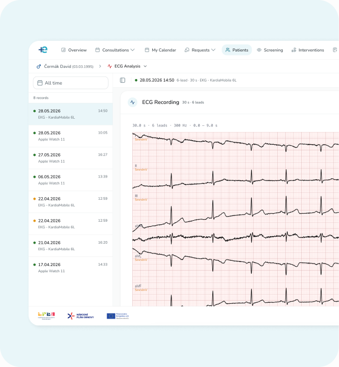 FNOL telemedicine ECG recordings with a timeline of measurements and multiple signal traces.